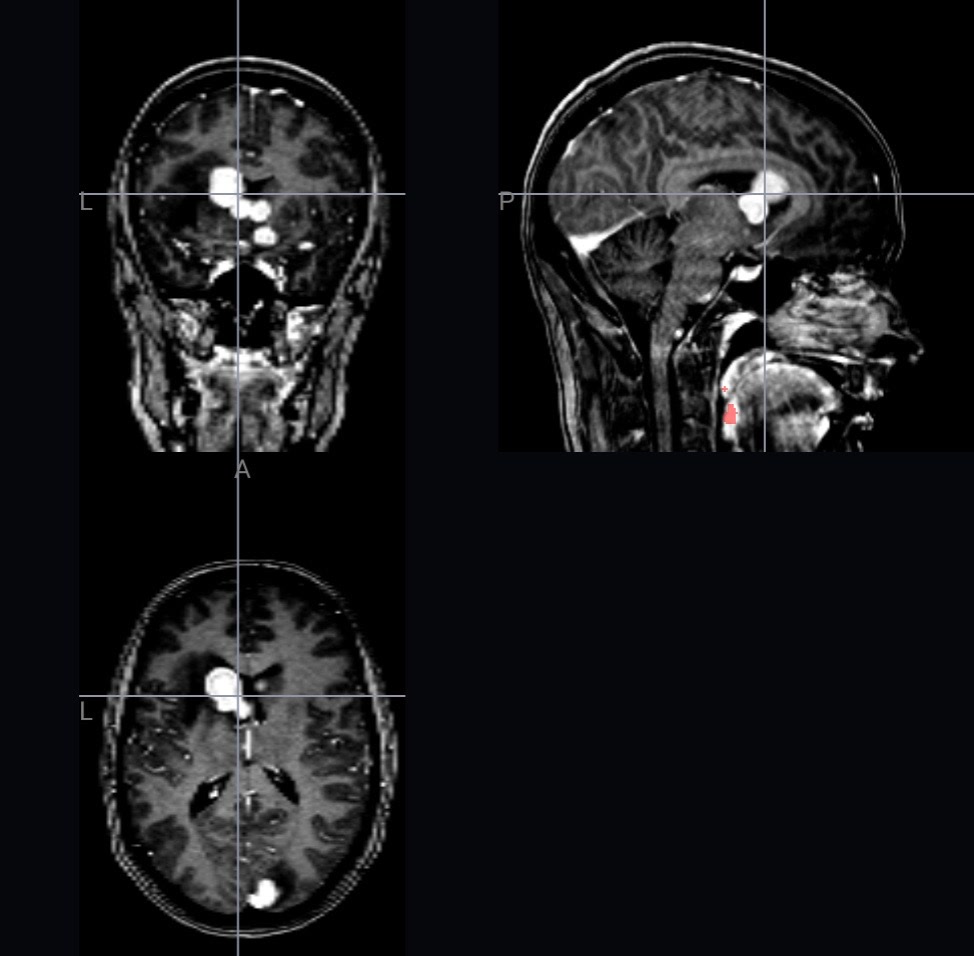De-identified multi-view research imaging of the brain