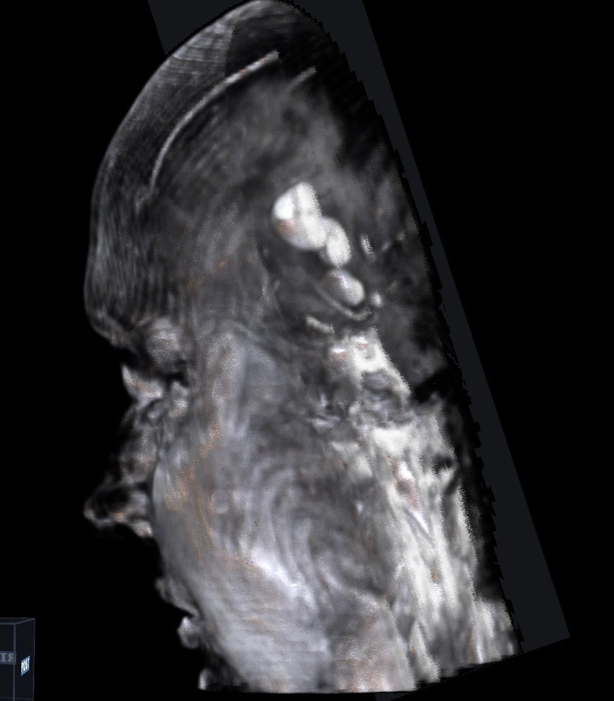 De-identified volumetric research imaging from a lateral perspective